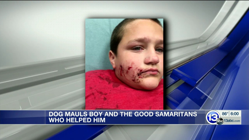 Graphic 12 Year Old Mauled By A Pit Bull Recovering At Home